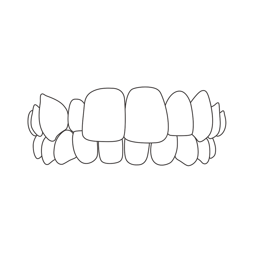 Group 313