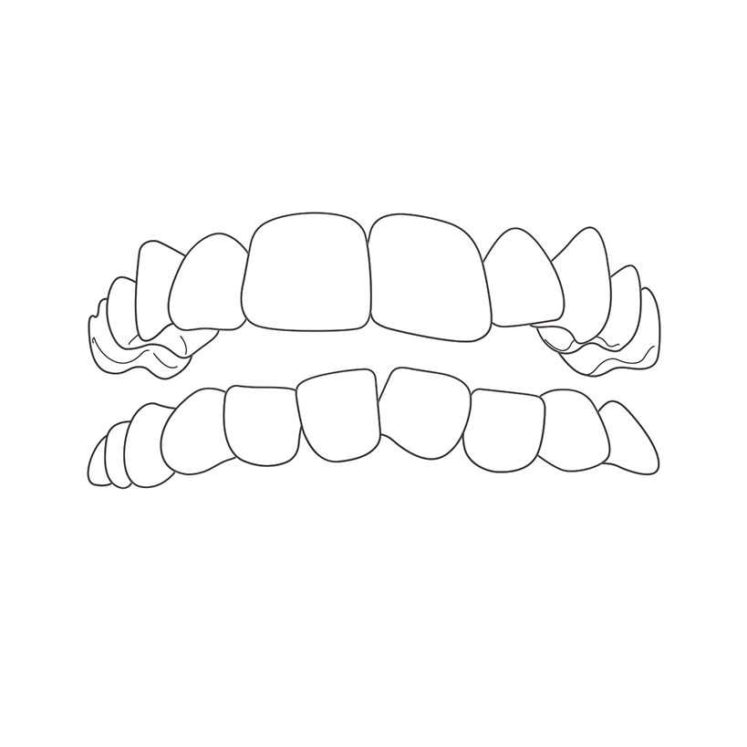 Group 315